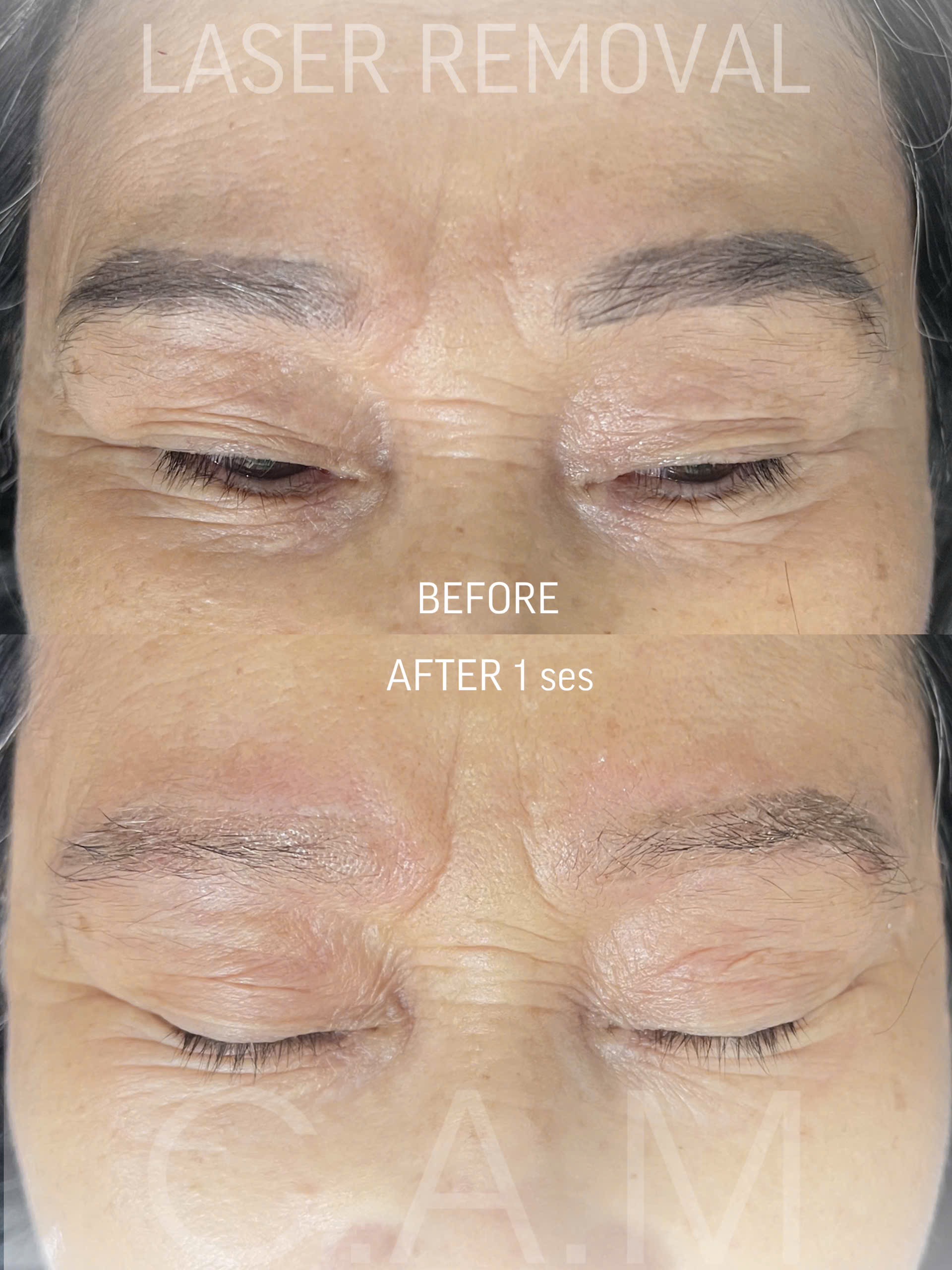 Img_2595